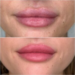 Diva Lips