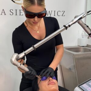 Eliminacion de micropigmentacion con láser Q-SWITCHED ND YAG fotoacustico ss