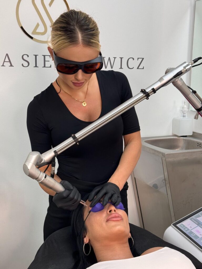 Eliminacion de micropigmentacion con láser Q-SWITCHED ND YAG fotoacustico ss