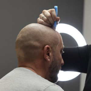 micropigmentacion caiplar banner